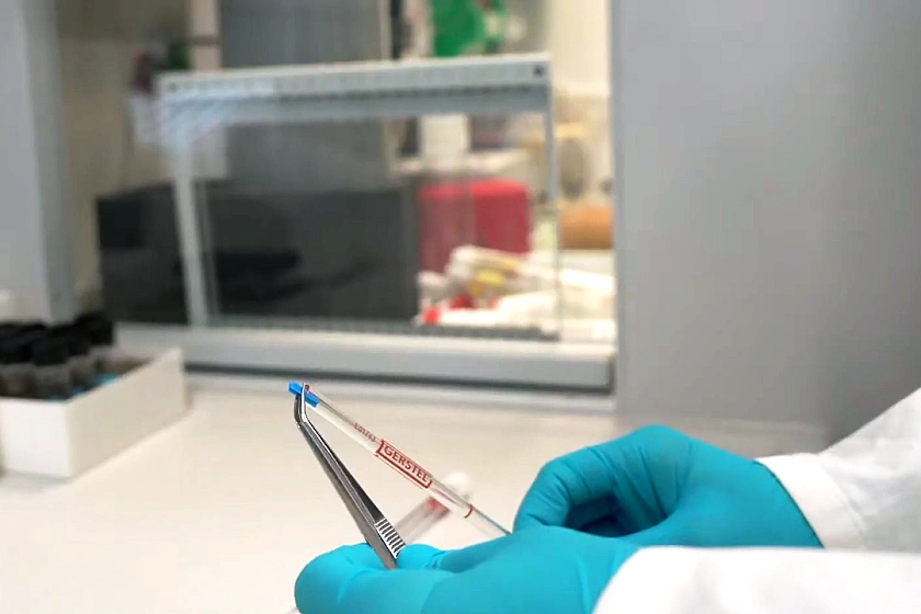 Testen der Absorptionskapazität